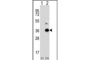 ANGPTL7 Antikörper  (C-Term)