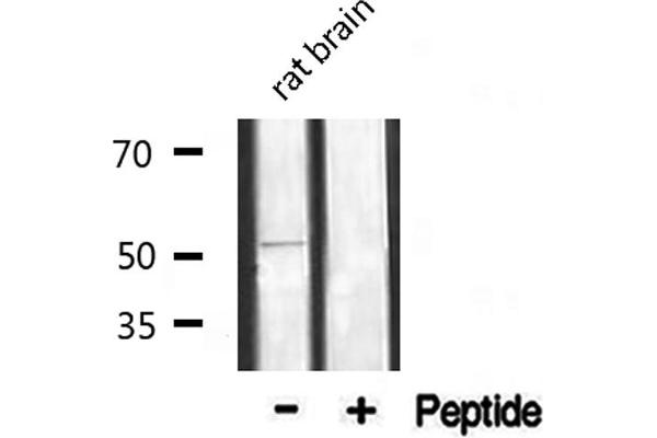 alpha 1 Adrenergic Receptor Antikörper  (Internal Region)