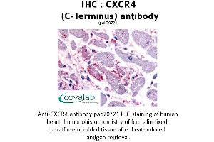 Image no. 1 for anti-Chemokine (C-X-C Motif) Receptor 4 (CXCR4) (C-Term) antibody (ABIN1733400) (CXCR4 Antikörper  (C-Term))