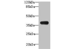 Western blot All lanes: ASB7 antibody at 8 μg/mL + A431 whole cell lysate Secondary Goat polyclonal to rabbit IgG at 1/10000 dilution Predicted band size: 37, 31 kDa Observed band size: 37 kDa (ASB7 Antikörper  (AA 1-274))