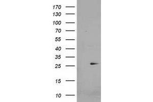 Western Blotting (WB) image for anti-Cyclin-Dependent Kinase Inhibitor 3 (CDKN3) antibody (ABIN1497458) (CDKN3 Antikörper)