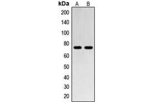 Western blot analysis of SENP1 expression in Jurkat (A), HL60 (B) whole cell lysates. (SENP1 Antikörper  (N-Term))