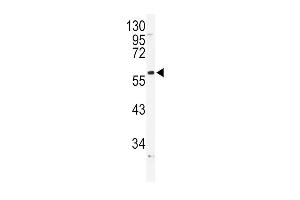 Western blot analysis of ADRA1B Antibody in NCI-H460 cell line lysates (35ug/lane) (ADRA1B Antikörper  (AA 270-297))