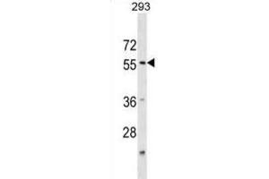 Western Blotting (WB) image for anti-Katanin P60 (ATPase Containing) Subunit A 1 (KATNA1) antibody (ABIN3000485) (KATNA1 Antikörper)