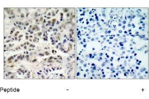 Image no. 1 for anti-Cyclin-Dependent Kinase Inhibitor 1B (p27, Kip1) (CDKN1B) (Ser10) antibody (ABIN197350) (CDKN1B Antikörper  (Ser10))