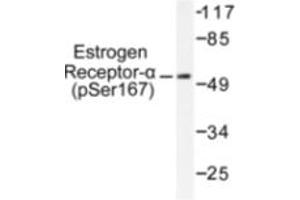 Image no. 1 for anti-Estrogen Receptor 1 (ESR1) (pSer167) antibody (ABIN318019) (Estrogen Receptor alpha Antikörper  (pSer167))