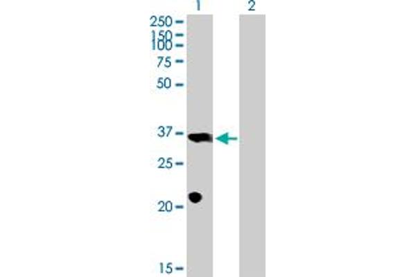 PROP1 Antikörper  (AA 1-226)