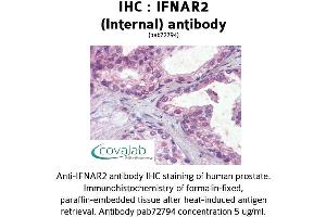 Image no. 2 for anti-Interferon alpha/beta Receptor 2 (IFNAR2) (Internal Region) antibody (ABIN1735773) (IFNAR2 Antikörper  (Internal Region))