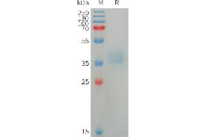 Azurocidin Protein (AA 27-248) (His tag)