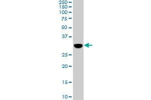 PRPS1L1 monoclonal antibody (M01), clone 5E10. (PRPS1L1 Antikörper  (AA 146-243))