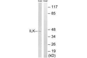 Western blot analysis of extracts from rat liver cells, using ILK (Ab-246) antibody. (ILK Antikörper  (Ser246))