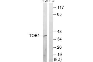 Western blot analysis of extracts from HT-29 cells, treated with serum (20%, 15mins), using TOB1 (epitope around residue 164) antibody. (Protein Tob1 (TOB1) (Ser164) Antikörper)
