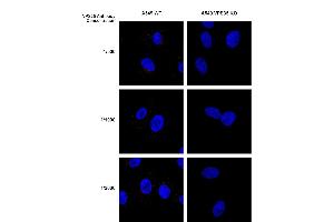 Immunocytochemistry/Immunofluorescence analysis using Mouse Anti-VPS35 Monoclonal Antibody, Clone 8A3 (ABIN6932968). (VPS35 Antikörper  (Biotin))