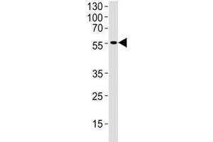 Western blot analysis of human brain tissue lysate using DCX antibody at 1:1000. (Doublecortin Antikörper  (AA 107-137))