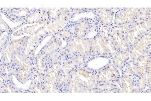 Detection of TGFb3 in Human Kidney Tissue using Polyclonal Antibody to Transforming Growth Factor Beta 3 (TGFb3) (TGFB3 Antikörper  (AA 274-372))