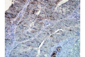 Immunohistochemistry analysis using Mouse Anti-Hsp90 Monoclonal Antibody, Clone D7alpha . (HSP90 Antikörper  (PE))