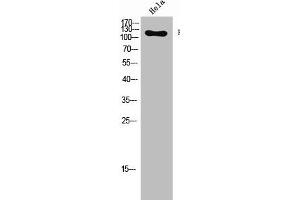Western Blot analysis of Hela cells using Phospho-Flg (Y654) Polyclonal Antibody (FGFR1 Antikörper  (pTyr654))