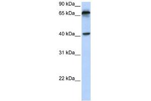 MICA antibody used at 1 ug/ml to detect target protein. (MICA Antikörper  (N-Term))