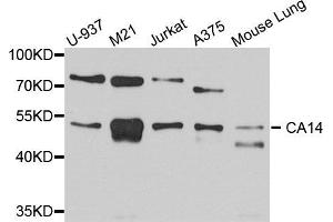 Western blot analysis of extracts of various cell lines, using CA14 antibody (ABIN5972614) at 1/1000 dilution. (CA14 Antikörper)
