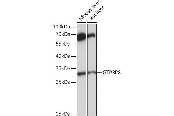 GTPBP8 Antikörper  (AA 1-170)