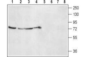 Western blot analysis of rat kidney (lanes 1 and 5), lung (lanes 2 and 6), liver (lanes 3 and 7) lysates and rat skeletal muscle membranes (lanes 4 and 8): - 1-4. (ADRA2B Antikörper  (2nd Extracellular Loop, Cys169))