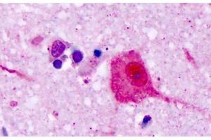 Anti-V1RL1 / VN1R1 antibody IHC staining of human brain, cortex, neurons. (VN1R1 Antikörper  (Extracellular Domain))