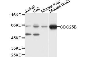 Western blot analysis of extracts of various cell lines, using CDC25B antibody. (CDC25B Antikörper)