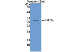 Western blot analysis of recombinant Human FKBP8. (FKBP8 Antikörper  (AA 93-339))