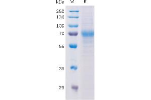 Human CD56 Protein, hFc Tag on SDS-PAGE under reducing condition. (LY9 Protein (AA 48-454) (His tag))