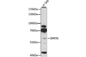 Western blot analysis of extracts of A-549 cells, using SPRTN antibody (ABIN4905287) at 1:3000 dilution. (Spartan Antikörper)