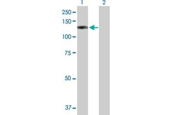 OSBPL8 Antikörper  (AA 1-847)