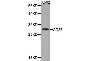 Western blot analysis of extracts of K562 cell lines, using CD83 antibody. (CD83 Antikörper  (AA 20-144))
