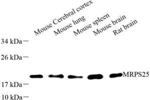 Western blot analysis of MRPS25 (ABIN7074653) at dilution of 1: 500 (MRPS25 Antikörper)