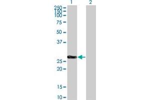 Western Blot analysis of CDKN1B expression in transfected 293T cell line by CDKN1B monoclonal antibody (M02), clone 2F4. (CDKN1B Antikörper  (AA 100-198))