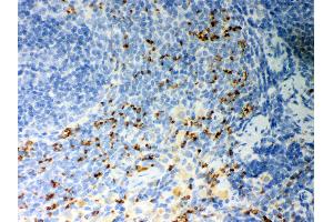 Anti- CD36 Picoband antibody, IHC(P) IHC(P): Rat Spleen Tissue (CD36 Antikörper  (N-Term))