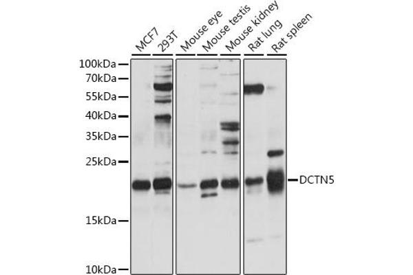 DCTN5 Antikörper  (AA 1-100)