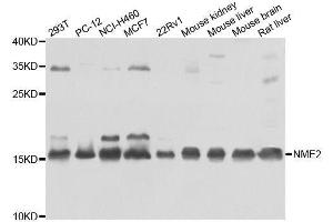 Western blot analysis of extracts of various cell lines, using NME2 antibody. (NME2 Antikörper  (AA 1-152))