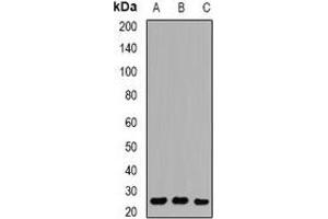 Western blot analysis of RAB27 expression in Hela (A), U937 (B), Jurkat (C) whole cell lysates. (RAB27A Antikörper)
