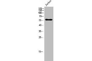 Western Blot analysis of Jurkat cells using CGI-43 Polyclonal Antibody (CCZ1B Antikörper  (C-Term))