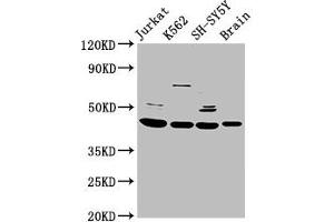 Western Blot Positive WB detected in: Jurkat whole cell lysate, K562 whole cell lysate, SH-SY5Y whole cell lysate, Rat brain tissue All lanes: HOXD3 antibody at 8. (HOXD3 Antikörper  (AA 263-346))