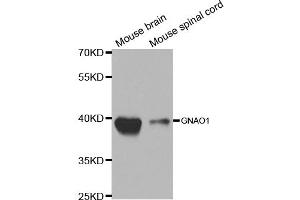 Western blot analysis of extracts of various cell lines, using GNAO1 antibody. (GNAO1 Antikörper)