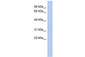 Image no. 1 for anti-STIP1 Homology and U-Box Containing Protein 1 (STUB1) (N-Term) antibody (ABIN6743148) (STUB1 Antikörper  (N-Term))