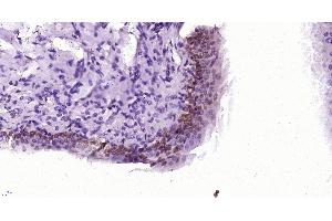 Paraformaldehyde-fixed, paraffin embedded rat bladder, Antigen retrieval by boiling in sodium citrate buffer (pH6) for 15min, Block endogenous peroxidase by 3% hydrogen peroxide for 30 minutes, Blocking buffer (normal goat serum) at 37°C for 20min, Antibody incubation with , Unconjugated  at 1:400 overnight at 4°C, followed by a conjugated secondary and DAB staining. (Ccl26 Signal Peptide (AA 1-70) Antikörper)