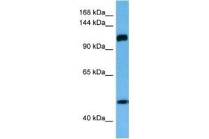 Host:  Rabbit  Target Name:  IFIH1  Sample Tissue:  Human Esophagus Tumor lysates  Antibody Dilution:  1ug/ml (IFIH1 Antikörper  (Middle Region))