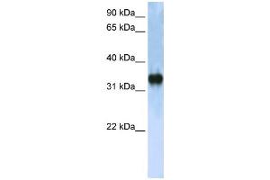 Western Blotting (WB) image for anti-Zinc Finger, CCHC Domain Containing 17 (ZCCHC17) antibody (ABIN2458243) (ZCCHC17 Antikörper)