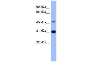 PRKY antibody used at 1 ug/ml to detect target protein. (PRKY Antikörper  (N-Term))