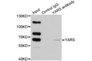 Immunoprecipitation analysis of 200 μg extracts of HeLa cells using 1 μg YARS antibody (ABIN5974115). (YARS Antikörper)