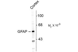 Western blots of rat cortex lysate showing specific immunolabeling of the ~ 50k GFAP protein. (GFAP Antikörper)