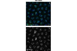 Immunofluorescence (Paraffin-embedded Sections) (IF (p)) image for anti-HIS2AV (pSer137) antibody (ABIN129671)