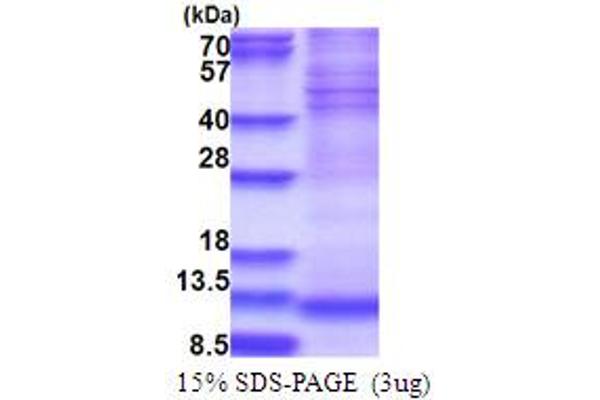 NDUFA4 Protein (AA 1-81) (His tag)